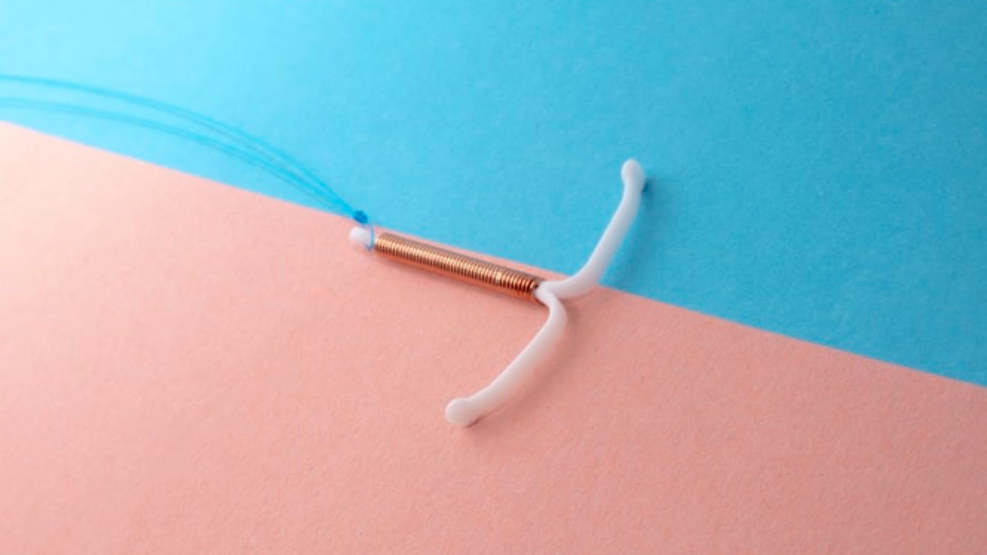 Consentimento conjugal para implementação de DIU é um ato machista, abusivo e ilegal