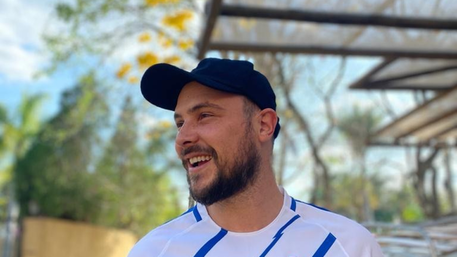 Sérgio Guizé exibe resultado de seu transplante capilar na web e diz: ”A gente tem que se cuidar”