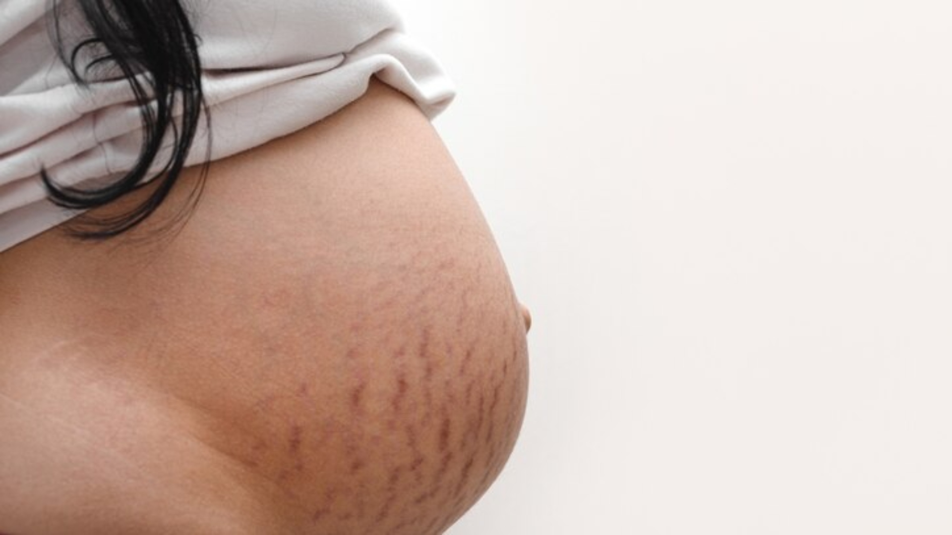 Como lidar com as modificações causados no corpo pela gravidez