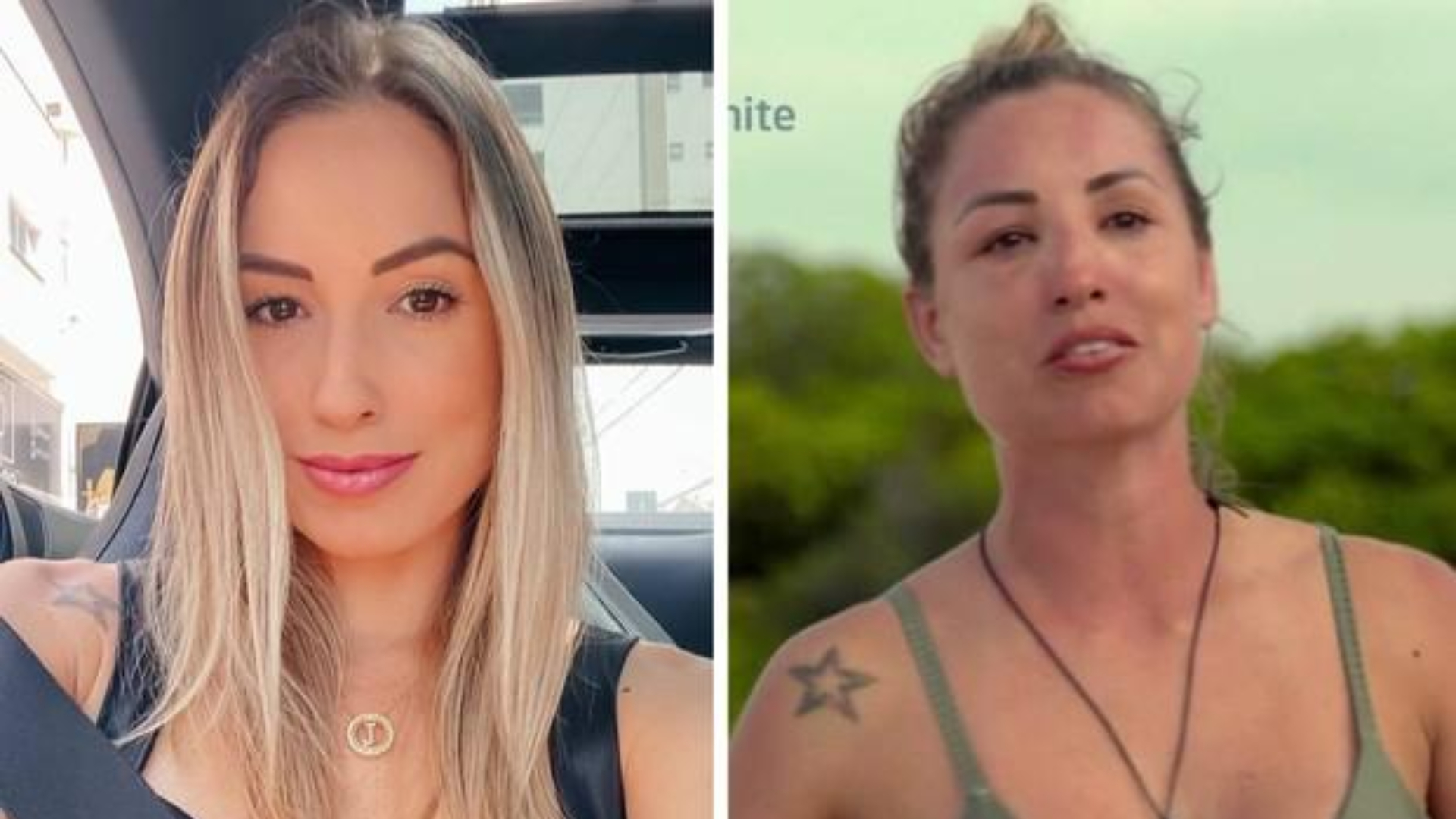 NO LIMITE: Inchaço no rosto de Jéssica chama atenção de internautas; médica explica o que aconteceu